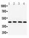 Actin Alpha 1, Skeletal Muscle antibody, PA5-78718, Invitrogen Antibodies, Western Blot image 