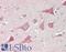Profilin 2 antibody, LS-B13581, Lifespan Biosciences, Immunohistochemistry paraffin image 