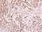 Minichromosome Maintenance Complex Component 4 antibody, GTX109740, GeneTex, Immunohistochemistry paraffin image 