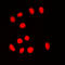 BRF1 RNA Polymerase III Transcription Initiation Factor Subunit antibody, GTX55860, GeneTex, Immunocytochemistry image 