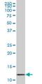 VAMP1 antibody, H00006843-M01, Novus Biologicals, Western Blot image 