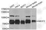 ATP Binding Cassette Subfamily F Member 2 antibody, A4365, ABclonal Technology, Western Blot image 