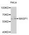 Mannan Binding Lectin Serine Peptidase 1 antibody, STJ27660, St John