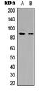 R3H Domain And Coiled-Coil Containing 1 Like antibody, orb304536, Biorbyt, Western Blot image 