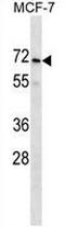 PRAME Family Member 2 antibody, AP53432PU-N, Origene, Western Blot image 