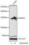 Poly(ADP-Ribose) Polymerase 1 antibody, GTX33387, GeneTex, Western Blot image 