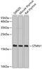 Stathmin 1 antibody, GTX32899, GeneTex, Western Blot image 