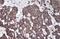Glucosidase Alpha, Acid antibody, GTX109821, GeneTex, Immunohistochemistry paraffin image 