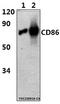 CD86 antibody, M00220-3, Boster Biological Technology, Western Blot image 