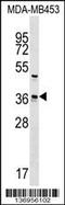 Ubiquitin Conjugating Enzyme E2 Z antibody, 59-041, ProSci, Western Blot image 