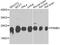 Proteasome Subunit Beta 3 antibody, A9947, ABclonal Technology, Western Blot image 