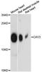Caveolin 3 antibody, A12769, ABclonal Technology, Western Blot image 