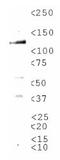 Transient Receptor Potential Cation Channel Subfamily M Member 8 antibody, TA336867, Origene, Western Blot image 