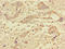 Protein Phosphatase 1 Catalytic Subunit Gamma antibody, LS-C397067, Lifespan Biosciences, Immunohistochemistry paraffin image 