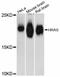 HRas Proto-Oncogene, GTPase antibody, STJ114104, St John