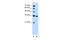 Solute Carrier Family 25 Member 29 antibody, ARP43788_T100, Aviva Systems Biology, Western Blot image 