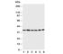 Cyclin Dependent Kinase 4 antibody, R30500, NSJ Bioreagents, Western Blot image 