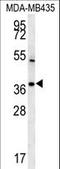 TNFAIP3 Interacting Protein 3 antibody, LS-C160083, Lifespan Biosciences, Western Blot image 