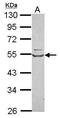 Tryptophanyl-TRNA Synthetase antibody, GTX113861, GeneTex, Western Blot image 