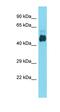 Desert Hedgehog Signaling Molecule antibody, orb331133, Biorbyt, Western Blot image 