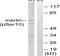 Neurofibromin 2 antibody, A00279S10, Boster Biological Technology, Western Blot image 