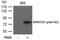 Myristoylated Alanine Rich Protein Kinase C Substrate antibody, 79-486, ProSci, Western Blot image 