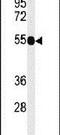 TNF Receptor Superfamily Member 8 antibody, PA5-26993, Invitrogen Antibodies, Western Blot image 