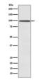 Sad1 And UNC84 Domain Containing 1 antibody, M03601-1, Boster Biological Technology, Western Blot image 