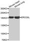 ERCC Excision Repair 6 Like, Spindle Assembly Checkpoint Helicase antibody, MBS127404, MyBioSource, Western Blot image 