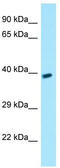 G Protein-Coupled Receptor 78 antibody, TA337932, Origene, Western Blot image 