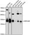 Mitochondrial Ribosomal Protein S18B antibody, A12085, ABclonal Technology, Western Blot image 