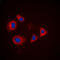 Protein Kinase CAMP-Dependent Type I Regulatory Subunit Alpha antibody, LS-B13583, Lifespan Biosciences, Immunofluorescence image 