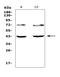 Tetraspanin 12 antibody, A05472-1, Boster Biological Technology, Western Blot image 