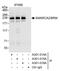 SWI/SNF Related, Matrix Associated, Actin Dependent Regulator Of Chromatin, Subfamily A, Member 2 antibody, A301-015A, Bethyl Labs, Immunoprecipitation image 