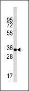 Caspase 6 antibody, PA5-12557, Invitrogen Antibodies, Western Blot image 