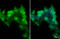 Cadherin 1 antibody, GTX124178, GeneTex, Immunofluorescence image 