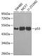 p53 antibody, 18-984, ProSci, Western Blot image 
