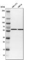 Serine/Threonine Kinase 4 antibody, HPA015270, Atlas Antibodies, Western Blot image 
