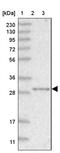 Nitrilase Family Member 2 antibody, PA5-57908, Invitrogen Antibodies, Western Blot image 