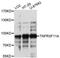 TNF Receptor Superfamily Member 11a antibody, LS-C748433, Lifespan Biosciences, Western Blot image 
