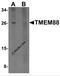 Transmembrane Protein 88 antibody, 6397, ProSci, Western Blot image 