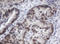 ACD Shelterin Complex Subunit And Telomerase Recruitment Factor antibody, LS-C173789, Lifespan Biosciences, Immunohistochemistry paraffin image 