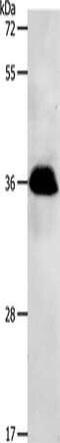 Protein Phosphatase 2 Catalytic Subunit Beta antibody, CSB-PA920060, Cusabio, Western Blot image 