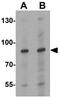 Nuclear cap-binding protein subunit 1 antibody, GTX31548, GeneTex, Western Blot image 