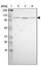 KH And NYN Domain Containing antibody, NBP1-81514, Novus Biologicals, Western Blot image 