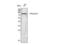 Dual Specificity Tyrosine Phosphorylation Regulated Kinase 1A antibody, STJ92800, St John