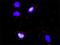 Collagen alpha-6(IV) chain antibody, H00001288-M01, Novus Biologicals, Proximity Ligation Assay image 