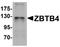 Zinc finger and BTB domain-containing protein 4 antibody, A08155, Boster Biological Technology, Western Blot image 