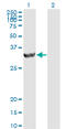 Proteasome Activator Subunit 2 antibody, LS-C133069, Lifespan Biosciences, Western Blot image 