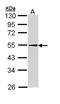 Perilipin 2 antibody, LS-B4850, Lifespan Biosciences, Western Blot image 